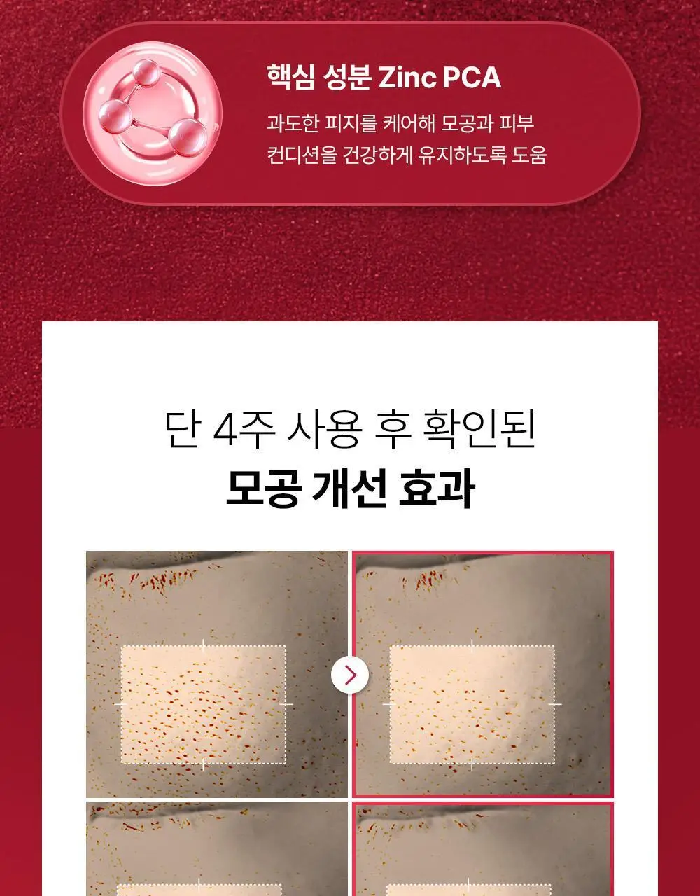 [리뉴얼/원조패드]코스알엑스 원스텝 패드 100매 4종 중 택1 상세페이지 17